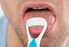 علل طعم تلخ و زردی بزاق در دهان چیست ؟ (2 نکته مهم)