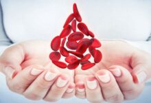علائم کم خونی : چگونه بفهمیم کم خونی داریم؟ (2 نکته مهم)