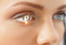 بیماری گلوکوم یا آب سیاه چه علل و علائمی دارد ؟ (2 نکته مهم)