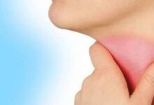 ۸ نشانه اصلی ابتلا به سرطان حنجره + راههای پیشگیری از این عارضه (2 نکته مهم)