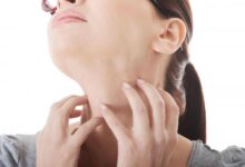 علت ، علائم و درمان سرطان غدد لنفاوی چیست ؟ (2 نکته مهم)