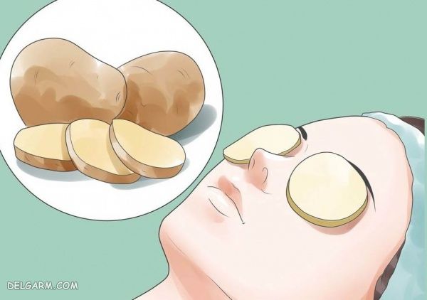 سیب زمینی برای خارش چشم