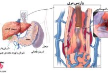 نشانه های ورم معده چیست؟ (2 نکته مهم)