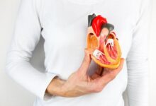 همه چیز در مورد بیماری قلبی نارسایی میترال (Mitral regurgitation) (2 نکته مهم)