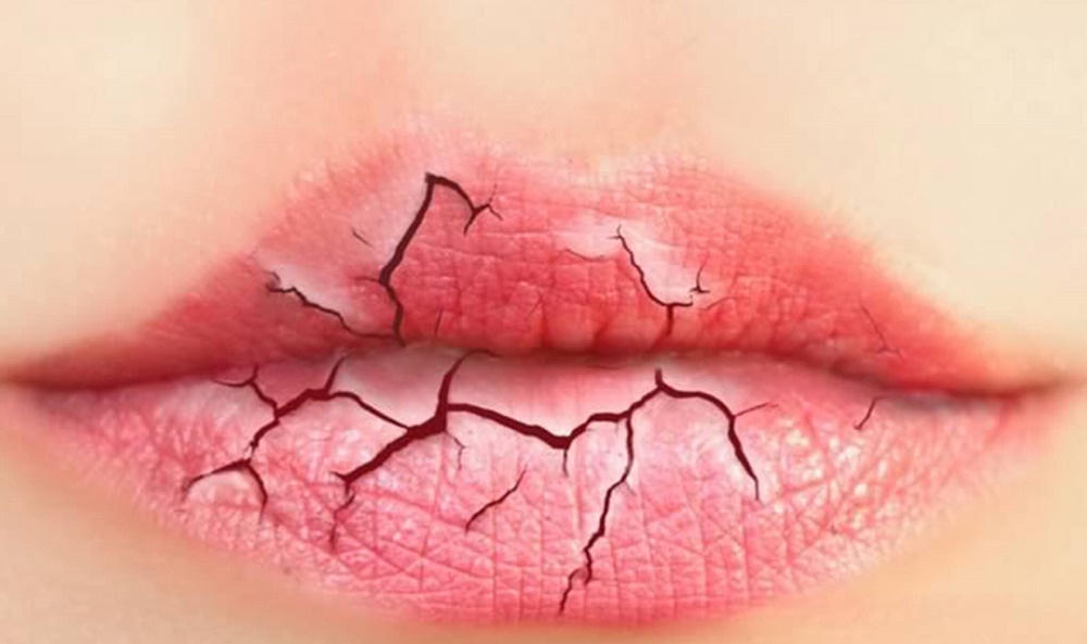 حساسیت لب به رژ حتما بخوانید! (2 نکته مهم) حساسیت لب به رژ حتما بخوانید! (2 نکته مهم)