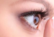 حساسیت چشم به لنز و عوارض آن (2 نکته مهم)