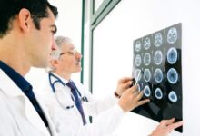 آیا علائم اولیه بیماری ام اس (ms) را میشناسید ؟ (2 نکته مهم)