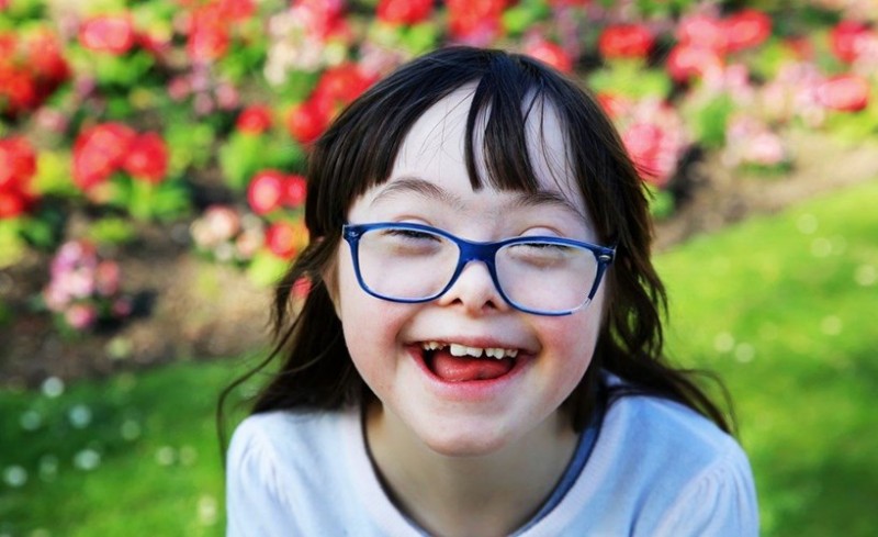 سندرم داون چیست؟ + بهترین راه برای پیشگیری از سندرم داون (2 نکته مهم)
