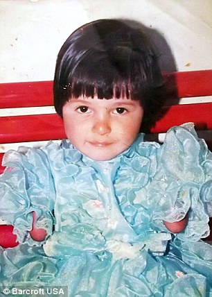 سندرم تترا آملیا - Tetra-amelia syndrome