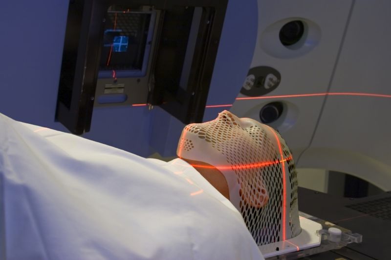 درمان سرطان های جامد و خوش خیم با پرتو درمانی (Radiotherapy ) (2 نکته مهم)