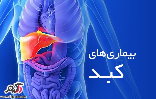 علل هپاتومگالی(بزرگی کبدی) چیست؟چگونه درمان میشود؟ (2 نکته مهم)