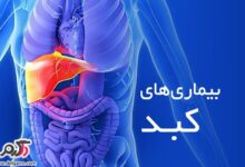 علل هپاتومگالی(بزرگی کبدی) چیست؟چگونه درمان میشود؟ (2 نکته مهم)