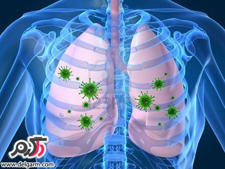 علائم از کار افتادن ریه ها (2 نکته مهم) علائم از کار افتادن ریه ها (2 نکته مهم)