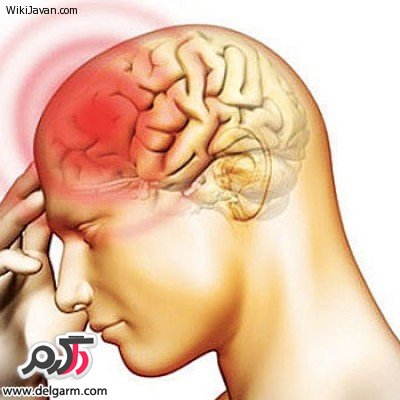آشنایی بیشتر با بیماری مننژیت (2 نکته مهم) آشنایی بیشتر با بیماری مننژیت (2 نکته مهم)