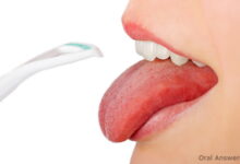 برای رفع سفیدی روی زبان چه کنیم؟ (2 نکته مهم)