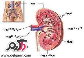 نشانه های درست کار نکردن کلیه چیست؟ (2 نکته مهم)