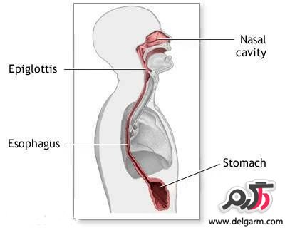 از بیماری مری بارت (Barrett’s esophagus) چه میدانید؟ (2 نکته مهم)