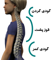 این بیماری شغلی را ساده نگیرید! (2 نکته مهم)