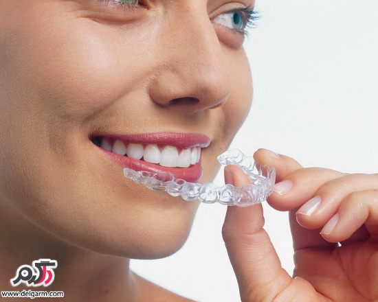 اورتودنسی و سئوالات درباره اورتودنسی