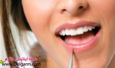 ترک خوردگی لب‌ها