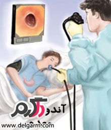 آندوسکوپی معده