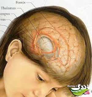 علایم تومور مغزی؟ (2 نکته مهم)