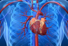 بزرگ شدن قلب چیست؟با علائم و دلایل بیماری بزرگی قلب آشنا هستید؟ (2 نکته مهم)