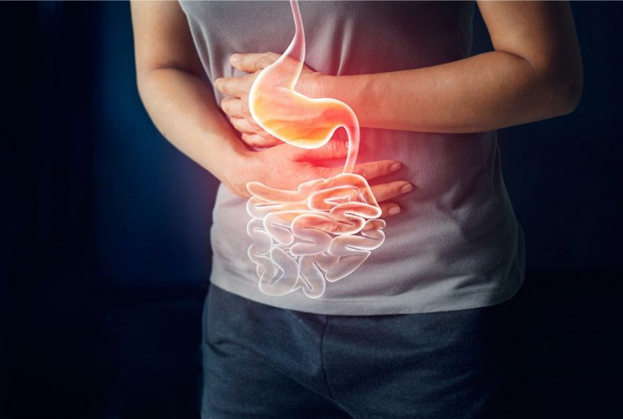 بهترین راه تشخیص سندرم لینچ کدام است؟ (2 نکته مهم) بهترین راه تشخیص سندرم لینچ کدام است؟ (2 نکته مهم)