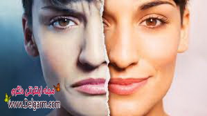 بیماری قطبی ودرمان آن (2 نکته مهم)