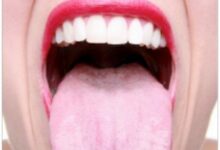 دلیل بزرگ شدن زبان کوچک چیست؟ (2 نکته مهم)