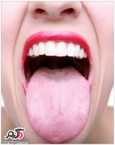 دلیل بزرگ شدن زبان کوچک چیست؟ (2 نکته مهم) دلیل بزرگ شدن زبان کوچک چیست؟ (2 نکته مهم)
