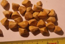 دلیل به وجود آمدن سنگ‌ کیسه صفرا چیست و چگونه درمان میشود ؟ (2 نکته مهم)