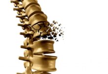 راه های جلوگیری از پوکی استخوان کدام است؟ (2 نکته مهم)