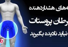 راه های مناسب برای پیشگیری از سرطان پروستات (2 نکته مهم)