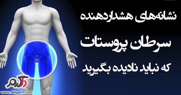 راه های مناسب برای پیشگیری از سرطان پروستات (2 نکته مهم) راه های مناسب برای پیشگیری از سرطان پروستات (2 نکته مهم)