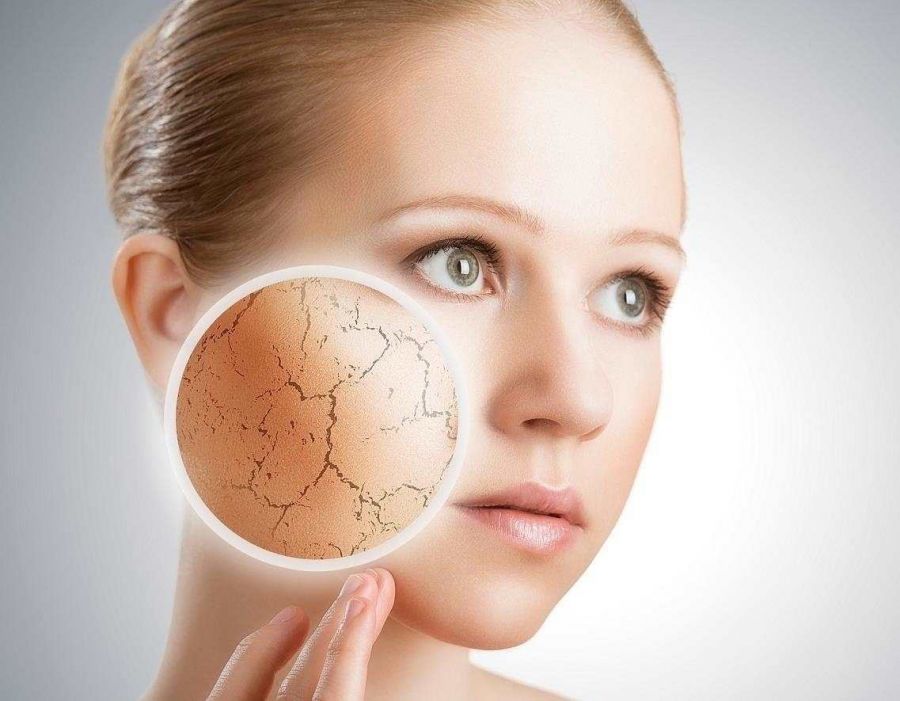 علائم بیماری پوستی ایکتیوز (ماهیاک) چیست؟ (2 نکته مهم)