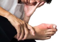 علائم نقرس پا چیست و چگونه درمان میشود ؟ (2 نکته مهم)