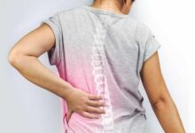 علت اسپوندیلیت آنکیلوزان + درمان گرفتگی و خشکی عضلات کمر (2 نکته مهم)
