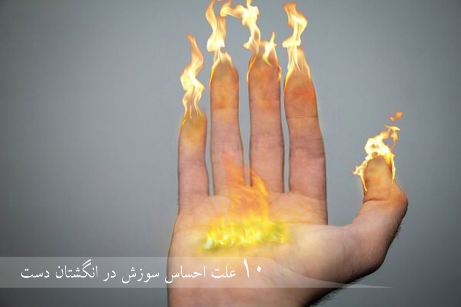 علت اصلی سوزش انگشتان دست چیست و چگونه درمان میشود ؟ (2 نکته مهم)