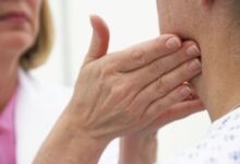 علت تورم غدد لنفاوی چیست؟ + درمان خانگی ورم غدد لفاوی (2 نکته مهم)