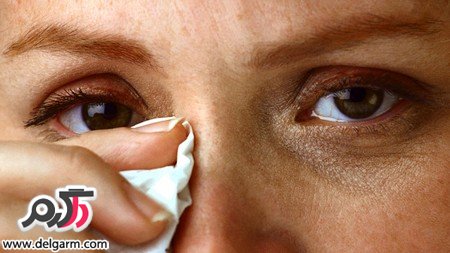 علت درد چشم در افراد چیست؟ (2 نکته مهم) علت درد چشم در افراد چیست؟ (2 نکته مهم)