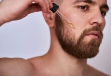 علت کچلی ریش چیست ؟ درمان ریزش سکه ای ریش آقایان (2 نکته مهم)