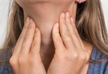 علل، علائم و راههای تشخیص گره تیروئید چیست ؟ (2 نکته مهم)