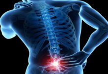 فرسایش دیسک کمر (دیسک سیاه) چیست و چه علائمی دارد ؟ (2 نکته مهم)