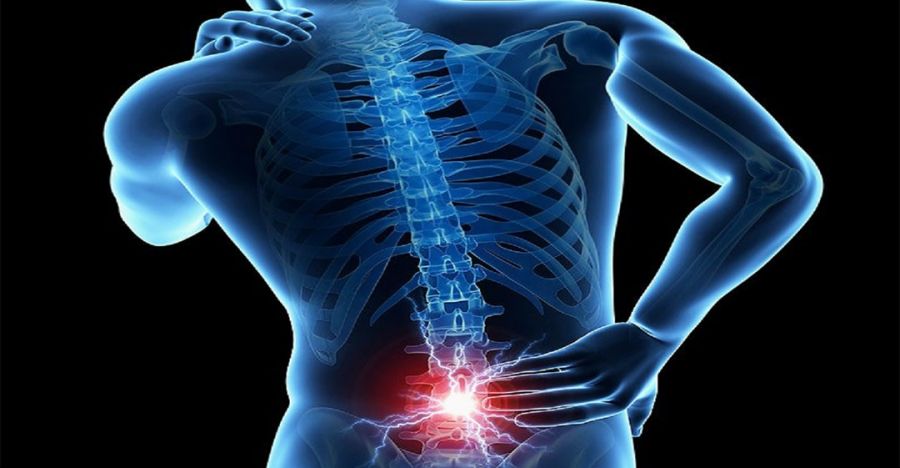 فرسایش دیسک کمر (دیسک سیاه) چیست و چه علائمی دارد ؟ (2 نکته مهم)