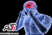 میگرن حاد ابتلا به این 3 بیماری را افزایش میدهد. (2 نکته مهم)