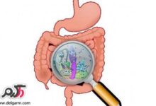 همه چیز در مورد بیماری کامپیلوباکتر ژژونی (Campylobacter jejuni) (2 نکته مهم)