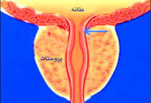 پروستات چیست؟ (2 نکته مهم)