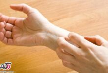 چرا پوست دچار خارش میشود؟ (2 نکته مهم)