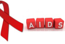 چه زمانی انجام آزمایش ایدز (HIV) لازم است؟ (2 نکته مهم)